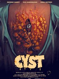 sortie dvd	
 Cyst