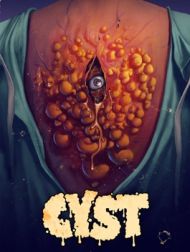 DVD Cyst