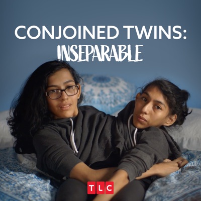 Télécharger Conjoined Twins: Inseparable