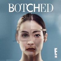Botched, Season 4 à télécharger 