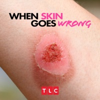 When Skin Goes Wrong, Season 1 à télécharger 