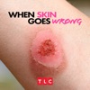 Télécharger When Skin Goes Wrong, Season 1